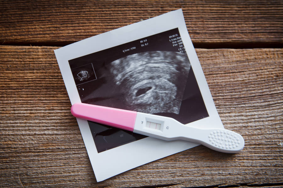 Pregnancy test kit and ultrasound image, supporting early pregnancy care and guidance at Hope Clinic for Women.